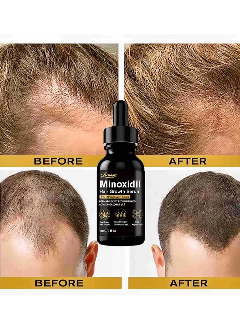 5% Minioxidil Hair Growth Serum for with Biotin Regrowth Hair Treatment For Thickens Hair Promotes Hair Density Help to Stop Thinning loss Hair stimulates Hair Growth, Regain Hair Serum-60ml-2