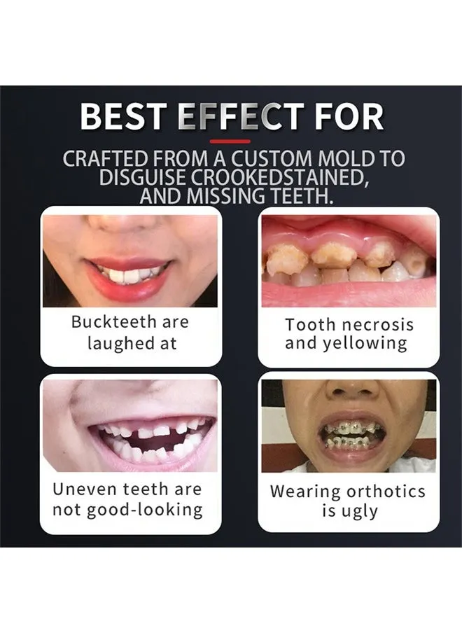 Denture Teeth, Fake Teeth Snap On Veneers Dentures Teeth for Upper and Lower Jaw, Silicone Non-Porous Braces, Nature and Comfortable, Protect Your Teeth and Regain Confident Smile for Men and Women-2