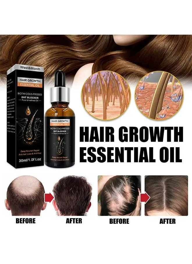 Hair Growth Essential Oil 30ml,Has The Effect Of Activating And Unblocking Pores, Repairing Hair Follicle Tubes, And Stimulating The Growth Of Dark Hair, Suitable For All Hair Types-1