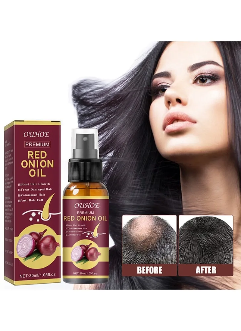 Premium Red Onion Hair Oil，Onion Thickening Spray 30ml Hair Oil with Onion Extract Onion Hair Growth Products for Men and Women Rapid Growth Anti-Hair Loss（Clear）-1