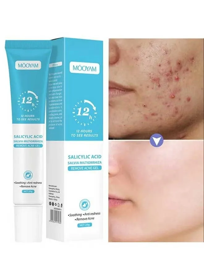 Salicylic Acid Remove Acne Gel 20g, Rapid Action Acne Spot Treatment for Face Closure & Acne Dots, Premium Acne Scar Gel & Pimple Remover-1