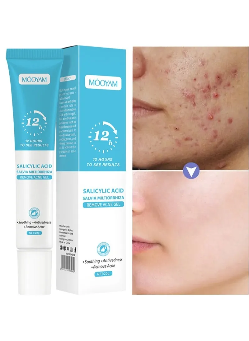 Salicylic Acid Salvia Miltiorrhiza Remove Acne Gel Lighten Acne Marks Remove Acne Shrink Pores Plant Essence - Fast Acne Removal in 12 Hours to See Results-1