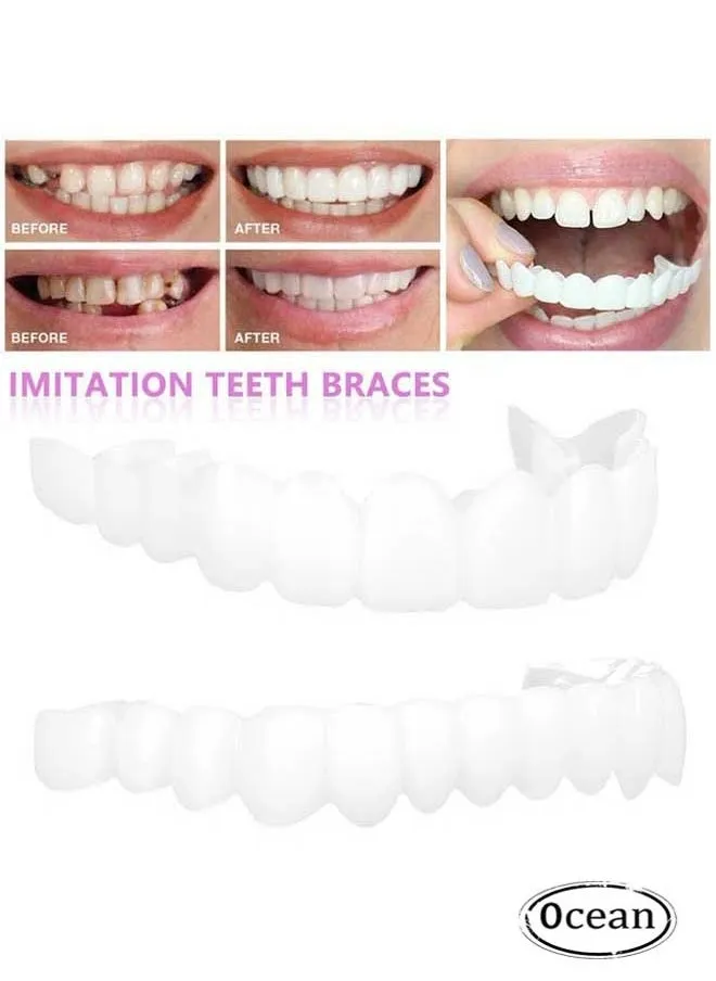 Upper and Lower Teeth Simulation Braces Snap on Smile Second Generation Simulation Braces Silicone Whitening Dentures Upper and Lower Teeth-2